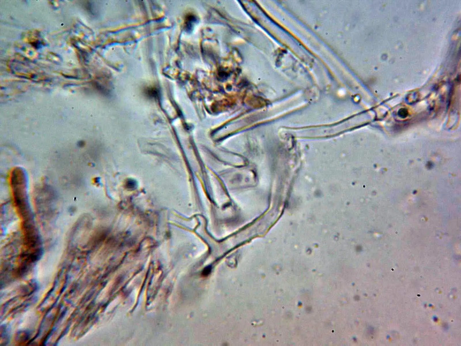 Microscopía de Phlebia albomellea - 10 - Hifas fibuladas